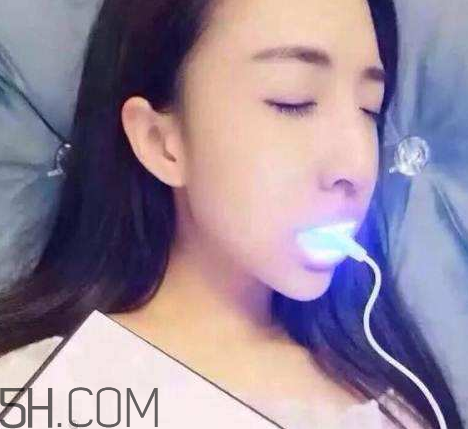 美牙仪用多久才有效果,美牙仪用多长时间就可以了