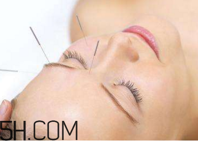能打瘦脸针吗,针灸能瘦脸吗