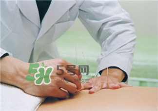 针灸减肥的疗效,针灸治疗减肥