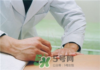 针灸减肥的利弊,针灸减肥的好处和功效