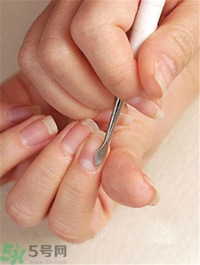 倒刺是怎么形成的,倒刺学名叫什么