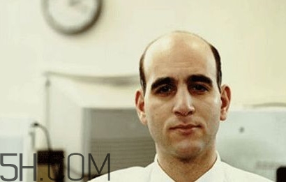 秃顶是不是跟性功能有关,秃顶的男的是不是性功能厉害 秃顶是不是跟性功能有关,秃顶的男的是不是性功能厉害