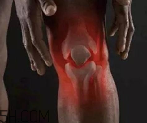 关节炎拔罐管用吗,关节炎能拔罐吗