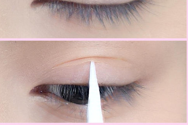 蕾丝双眼皮贴会让眼皮松弛吗,蕾丝双眼皮贴的缺点