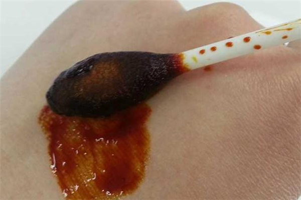 衣服上的碘伏如何去掉,怎么去掉衣服上的碘伏 衣服上的碘伏如何去掉,怎么去掉衣服上的碘伏