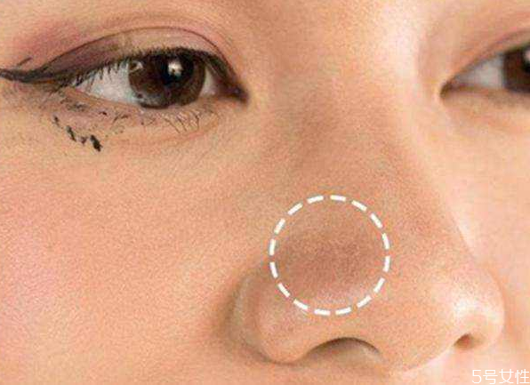 嘴角卡粉是怎么回事,嘴角卡粉怎么办