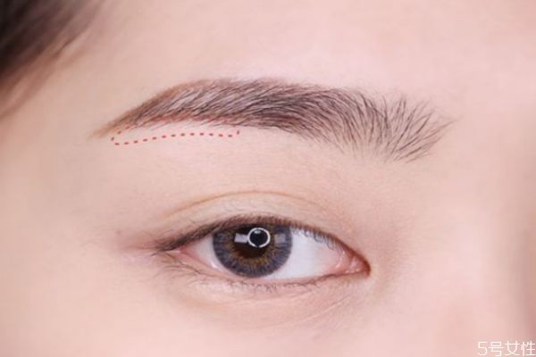 眉笔过敏的症状,眉笔过敏会有什么症状