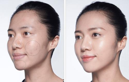 遮瑕可以遮疤痕吗,遮瑕膏能遮住疤痕吗