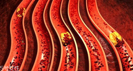 血管营养素,补充血管营养素吃什么 血管营养素,补充血管营养素吃什么