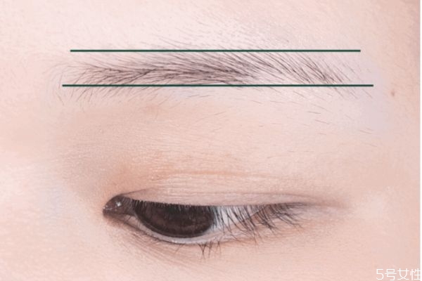 芙清凝胶含激素吗(芙清综合治疗凝胶含有激素吗)