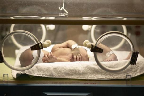 新生儿黄疸怎么引起的(新生儿黄疸是怎样的) 新生儿黄疸怎么引起的(新生儿黄疸是怎样的)