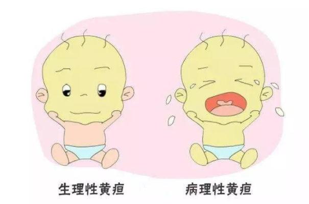 生理性黄疸的特点(生理性黄疸的特点正确的是)
