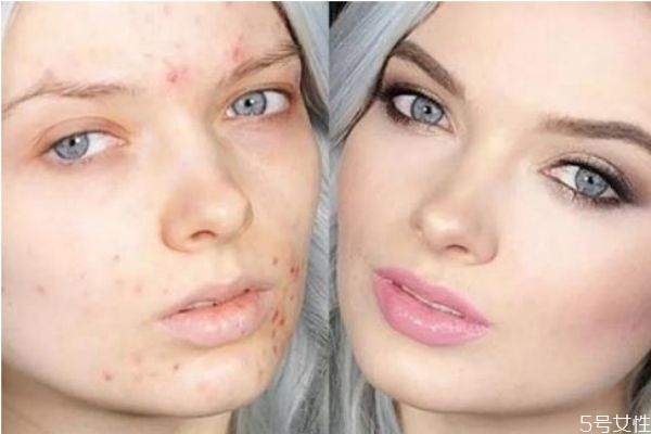 如何避免搓泥(如何避免搓泥现象)