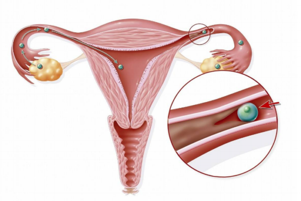 护巢的8大注意(怎么样保护好卵巢)