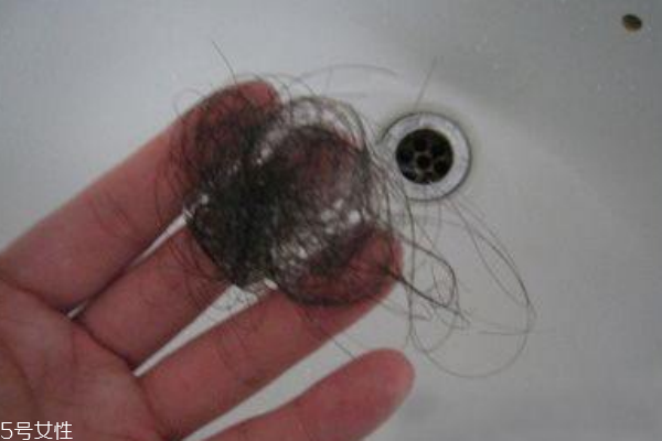 脱发怎么办(脱发怎么办女性)