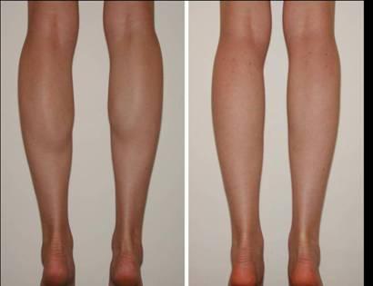 拉筋能瘦小腿吗(站拉筋板可以瘦小腿吗)