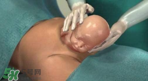 剖腹产的流程及时间,剖腹产手术过程详解