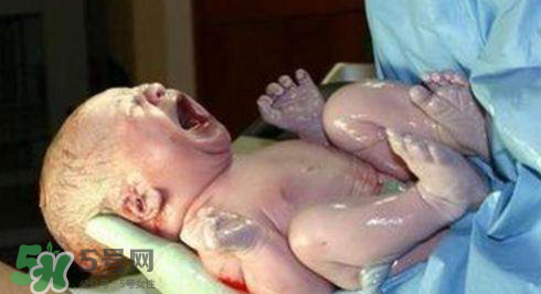 婴儿剪脐带会不会疼,孩子剪脐带的时候妈妈会疼吗