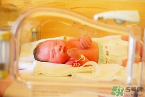 新生儿黄疸高怎么办,出生儿童黄疸高怎么办