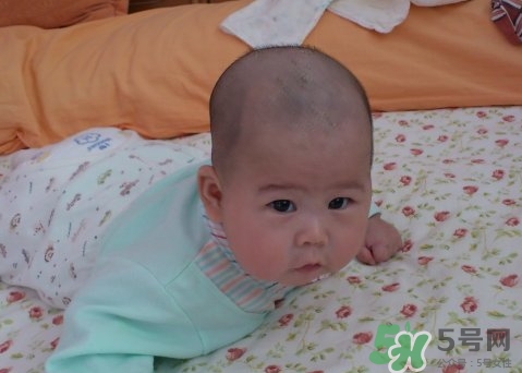 新生儿身上很多黑毛是咋回事,新生儿身上为什么会有黑黑的毛