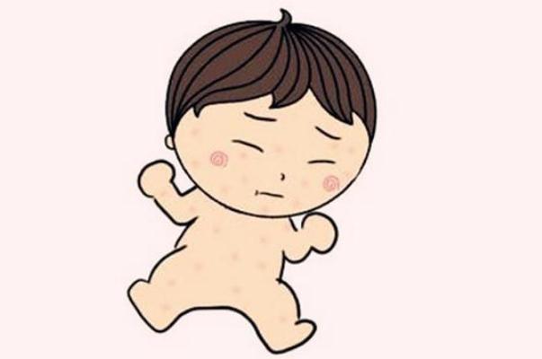 婴儿出湿疹是什么原因,怎样治疗,婴儿出湿疹是什么原因引起的