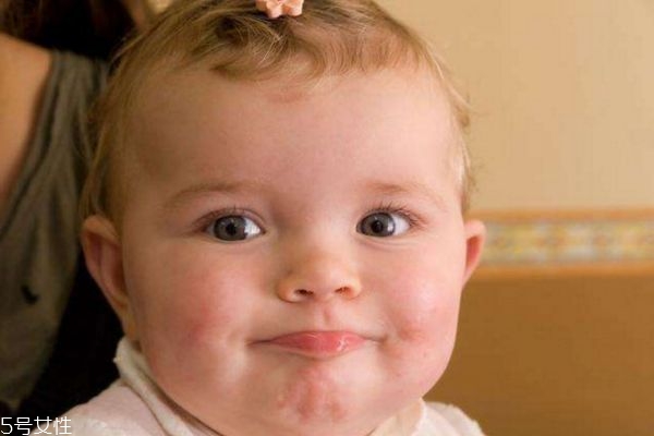 婴儿的脸能捏吗,为什么不可以捏宝宝的脸