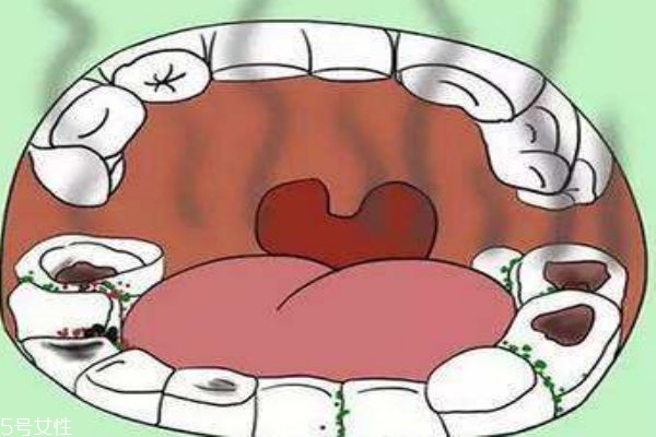 宝宝嘴巴里有臭鸡蛋味是怎么回事,宝宝嘴巴像臭鸡蛋味怎么办