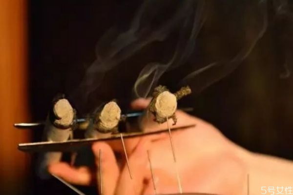 艾灸肚脐有什么作用,艾草贴肚脐眼有什么功效 艾灸肚脐有什么作用,艾草贴肚脐眼有什么功效