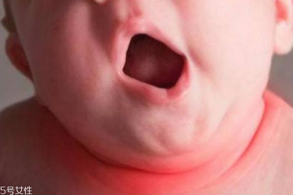 淹脖子是什么意思,淹脖子是什么原因 淹脖子是什么意思,淹脖子是什么原因