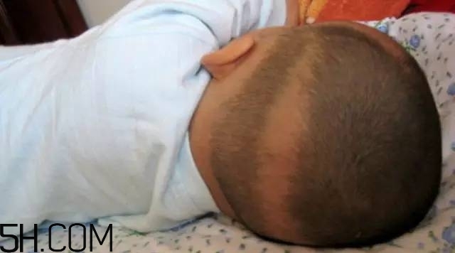 宝宝枕秃是什么原因引起的,宝宝为什么会出现枕秃 宝宝枕秃是什么原因引起的,宝宝为什么会出现枕秃