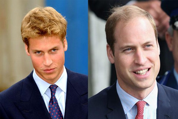 梅花针治疗脱发有用吗,梅花针治疗脱发有用吗 m.由来.cn