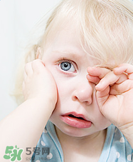 宝宝眼睛红痒老是用手揉怎么办,宝宝眼睛痒老是揉眼睛怎么办