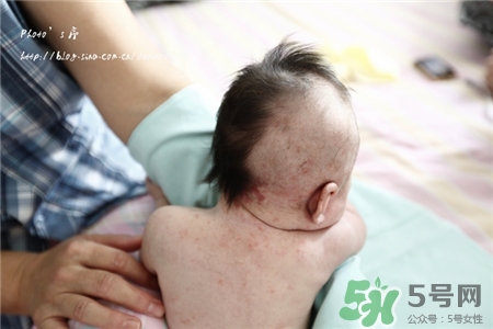 宝宝冬天能剃光头吗,冬天宝宝头发剃光好吗