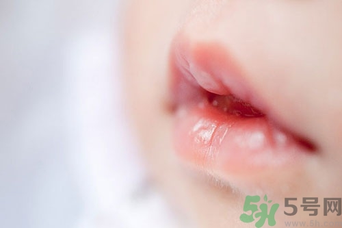 宝宝嘴起干皮是什么原因怎么办,宝宝嘴巴经常干起皮是怎么回事