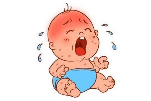 宝宝脸上有奶癣怎么办,宝宝脸上长奶癣是什么引起的