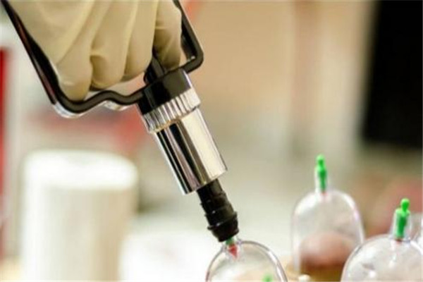 拔火罐需要多少钱一次,拔火罐需要多少钱