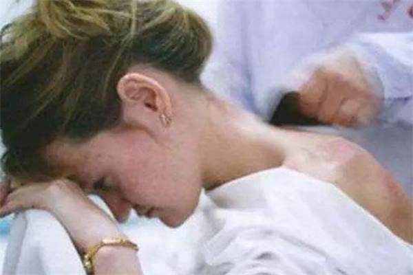 刮痧可以去火吗?,刮痧祛火吗