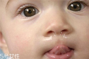 宝宝经常流鼻涕是什么原因,孩子整天流鼻涕是怎么了