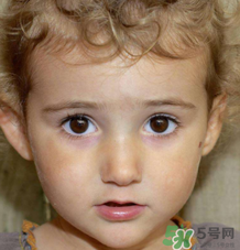 小儿热性惊厥的临床表现,婴儿热性惊厥症状 小儿热性惊厥的临床表现,婴儿热性惊厥症状