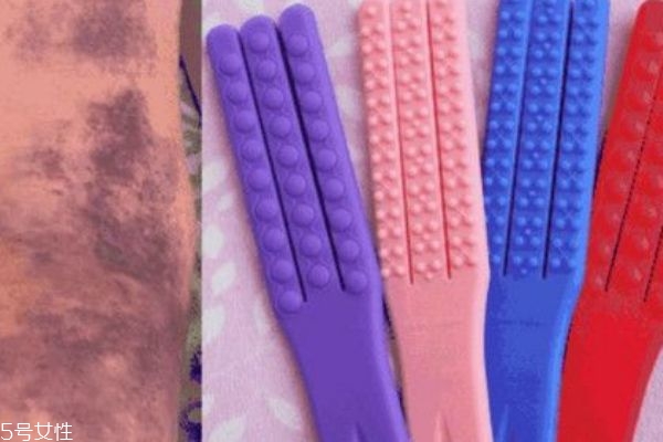 拍痧的颜色代表什么图解,拍痧的颜色代表什么病症 拍痧的颜色代表什么图解,拍痧的颜色代表什么病症