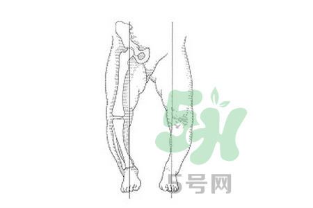 膝内翻为什么是O型腿,膝内翻是o型腿吗