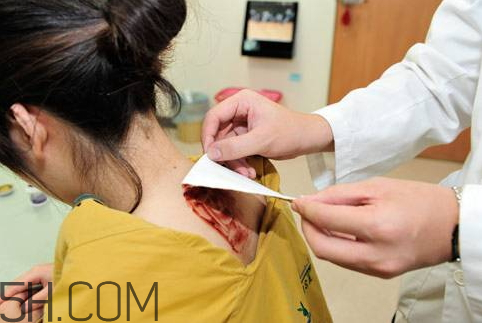 三九贴多少钱一盒管胃寒的,三九贴多少钱一盒