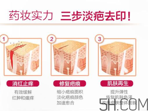 怡思丁祛疤膏使用方法,怡思丁疤痕膏怎么用