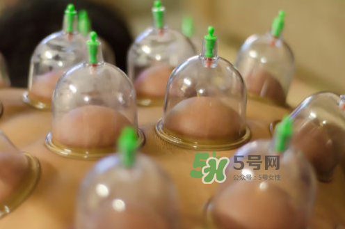 拔火罐夏天和冬天哪个效果好,冬天拔火罐好不好
