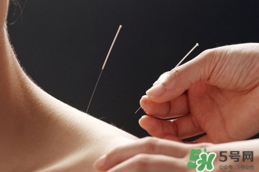 针灸可以治疗哪些病效果好,中医针灸能治疗什么病