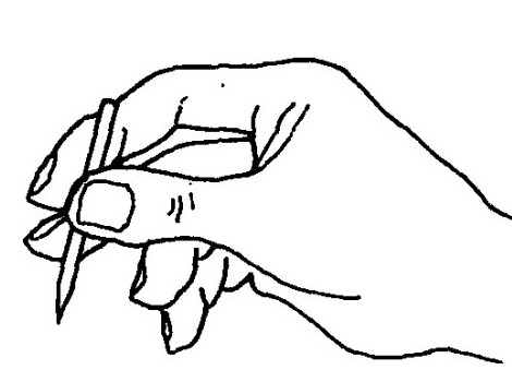 刺络放血疗法多久一次,放血疗法多久一次