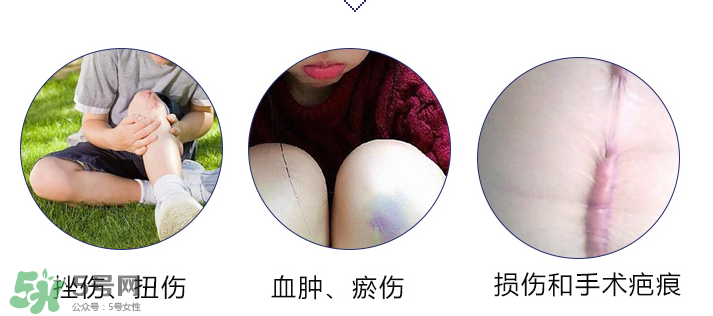 hirudidoid祛疤膏,hirudoid祛疤膏