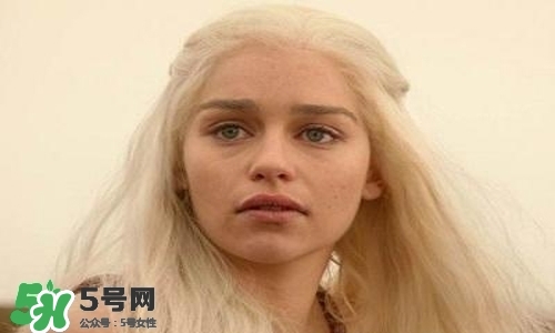 脸黄是怎么回事,脸上黄怎么回事