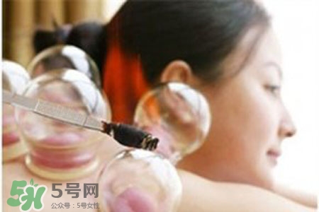 春天拔罐好吗?,冬天拔罐好吗?