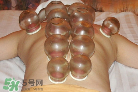 拔罐分季节吗,拔罐分不分季节